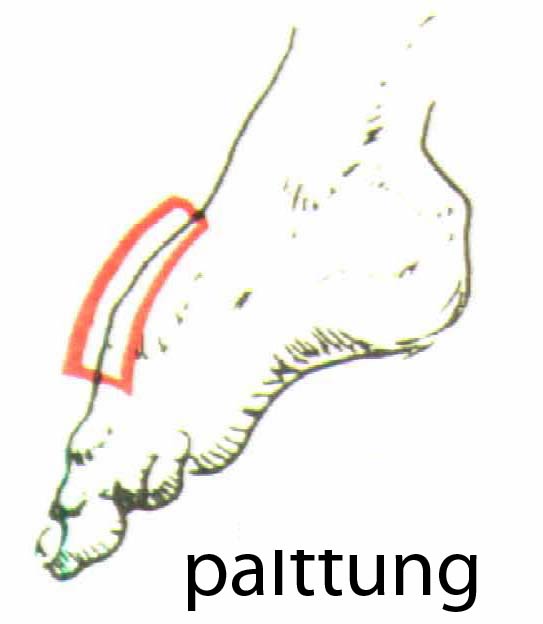 palttung